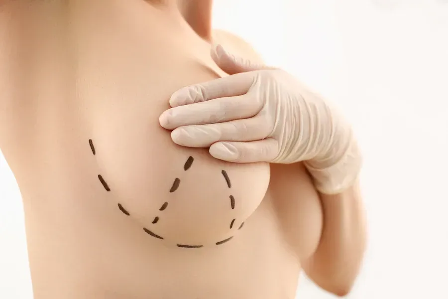 Jakie znieczulenie podaje się przed powiększeniem piersi?