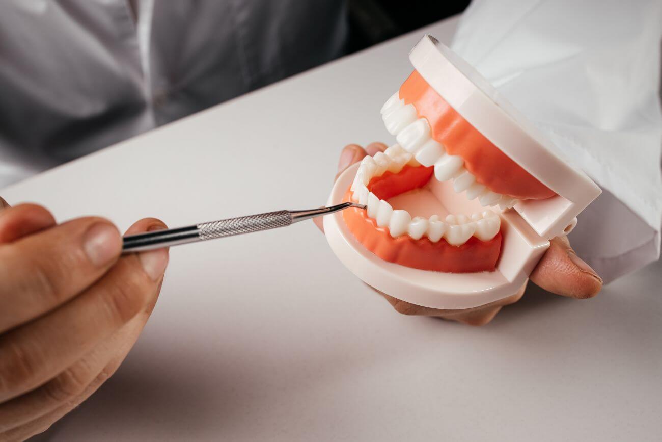 Czy implanty zęba są bezpieczne?